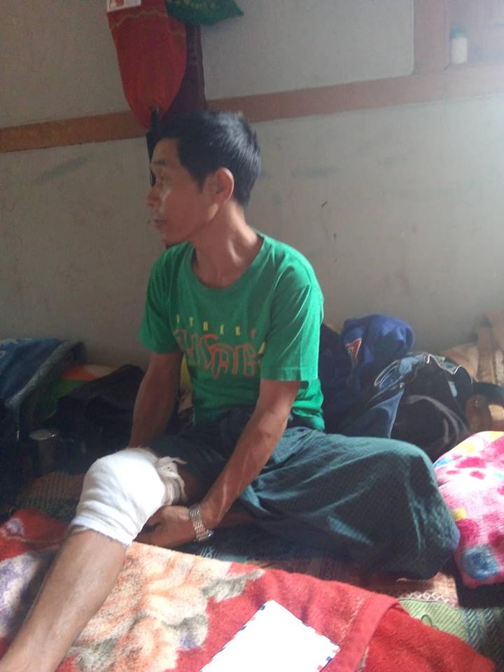 Awng Lawt villager Yaw Han injured by Burma Army shelling
